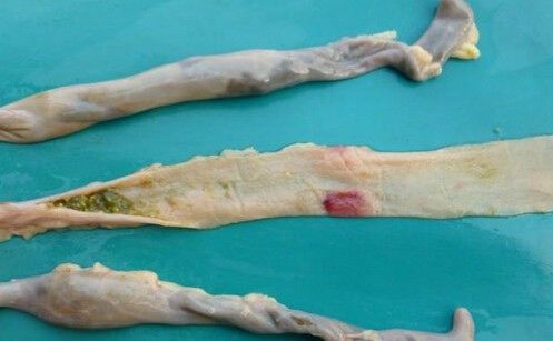 雞壞死性腸炎